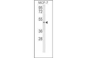 Western blot analysis of SCD5 Antibody (Center) Cat. (SCD5 anticorps  (Middle Region))