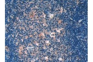 Detection of GAL9 in Mouse Lymph node Tissue using Polyclonal Antibody to Galectin 9 (GAL9)