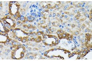 Immunohistochemistry of paraffin-embedded Mouse kidney using KRT14 Polyclonal Antibody at dilution of 1:100 (40x lens). (KRT14 anticorps)
