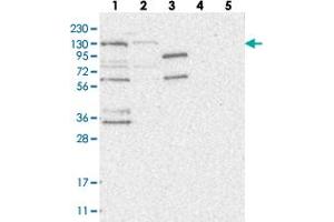 Western blot analysis of Lane 1: RT-4, Lane 2: U-251 MG, Lane 3: Human Plasma, Lane 4: Liver, Lane 5: Tonsil with HEATR6 polyclonal antibody . (HEATR6 anticorps)