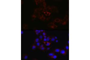 Immunofluorescence analysis of HepG2 cells using ApoB Rabbit pAb (ABIN3015447, ABIN3015448, ABIN5663872 and ABIN6217244) at dilution of 1:50 (40x lens). (APOB anticorps  (AA 28-330))