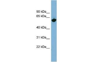 WB Suggested Anti-GPNMB Antibody Titration:  0.