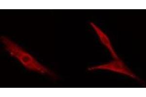 ABIN6278590 staining NIH-3T3 cells by IF/ICC. (MDM1 anticorps  (Internal Region))