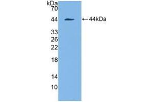WB of Protein Standard: different control antibodies against Highly purified E. (Cytokeratin 7 Kit ELISA)