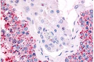 Anti-CDC7 antibody  ABIN1048420 IHC staining of human testis. (CDC7 anticorps  (Kinase Domain))