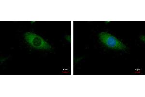 ICC/IF Image BCAR1 antibody [N2C2], Internal detects BCAR1 protein at cytoplasm by immunofluorescent analysis.