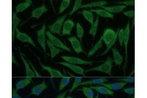 Immunofluorescence analysis of L929 cells using KIF14 Polyclonal Antibody at dilution of 1:100 (40x lens).