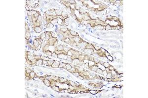 Immunohistochemistry of paraffin-embedded mouse kidney using Aquaporin-1  Rabbit pAb (ABIN7265651) at dilution of 1:100 (40x lens).