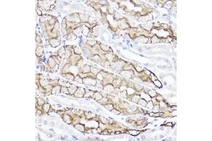 Immunohistochemistry of paraffin-embedded mouse kidney using Aquaporin-1  Rabbit pAb (ABIN7265651) at dilution of 1:100 (40x lens). (Aquaporin 1 anticorps  (C-Term))