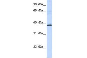 HAO2 antibody used at 1 ug/ml to detect target protein. (Hydroxyacid Oxidase 2 (HAO2) anticorps)