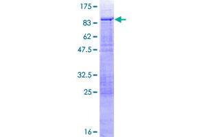 Image no. 1 for Phosphatase and Actin Regulator 3 (PHACTR3) (AA 1-448) protein (GST tag) (ABIN1314854)