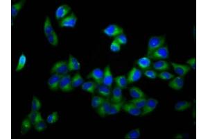 Immunofluorescence staining of Hela cells with ABIN7150052 at 1:166, counter-stained with DAPI. (ADAM29 anticorps  (AA 701-820))