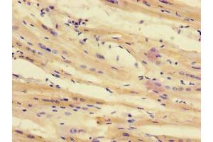Immunohistochemistry of paraffin-embedded human heart tissue using ABIN7171701 at dilution of 1:100 (TTI1 anticorps  (AA 692-858))