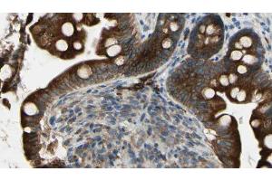 ABIN6269326 at 1/100 staining Mouse intestine tissue by IHC-P. (GRIN1/NMDAR1 anticorps  (C-Term))