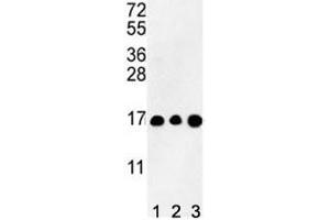 Western blot analysis of HIST3H3 antibody and (1) CEM, (2) K562, and (3) HL-60 lysate