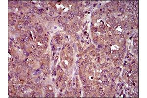 Immunohistochemistry (IHC) image for anti-Interleukin 3 Receptor, alpha (IL3RA) (AA 200-305) antibody (ABIN1845738) (IL3RA anticorps  (AA 200-305))