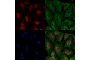 ABIN7093646 and ABIN7097672 staining  cells by IF/ICC. (HBP1 anticorps)