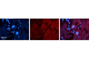 Rabbit Anti-SF1 Antibody   Formalin Fixed Paraffin Embedded Tissue: Human heart Tissue Observed Staining: Nucleus Primary Antibody Concentration: 1:100 Other Working Concentrations: N/A Secondary Antibody: Donkey anti-Rabbit-Cy3 Secondary Antibody Concentration: 1:200 Magnification: 20X Exposure Time: 0. (Splicing Factor 1 anticorps  (Middle Region))