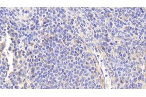 Detection of eNOS in Human Spleen Tissue using Polyclonal Antibody to Endothelial NOS (eNOS)
