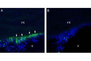 Expression of GP130/CD130 in rat subfornical organ (SFO).