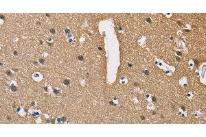 Immunohistochemistry of paraffin-embedded Human brain using PPP3CA Polyclonal Antibody at dilution of 1:40