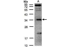 WB Image Sample(30 μg of whole cell lysate) A:H1299 12% SDS PAGE antibody diluted at 1:500 (FN3KRP anticorps)