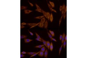 Immunofluorescence analysis of NIH/3T3 cells using Galectin 3/LG Rabbit mAb (ABIN7267337) at dilution of 1:50 (40x lens).