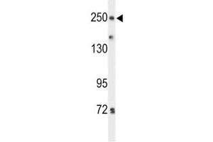 Western blot analysis of PTPRD antibody and HeLa lysate.