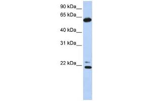 Western Blotting (WB) image for anti-Chaperonin Containing TCP1, Subunit 5 (Epsilon) (CCT5) antibody (ABIN2459816) (CCT5 anticorps)