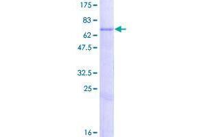 Image no. 1 for Carbohydrate (Chondroitin 4) Sulfotransferase 12 (CHST12) (AA 1-414) protein (GST tag) (ABIN1349429)