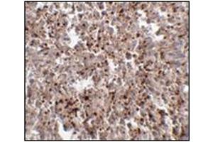 Immunohistochemistry of Mett7LB in human spleen tissue with this product at 2. (METTL7B anticorps  (C-Term))