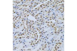 Immunohistochemistry of paraffin-embedded rat kidney using ILK Antibody. (ILK anticorps  (AA 1-260))