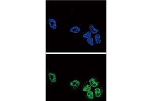 Confocal immunofluorescent analysis of PLA2G4A Antibody with NCI-H460 cell followed by Alexa Fluor488-conjugated goat anti-rabbit lgG (green). (PLA2G4A anticorps  (AA 513-541))