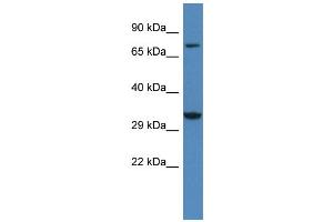 WB Suggested Anti-Cacng2 Antibody   Titration: 1. (Stargazin anticorps  (Middle Region))