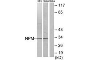 Western blot analysis of extracts from HeLa/NIH-3T3 cells, using NPM (Ab-234) Antibody. (NPM1 anticorps  (AA 201-250))
