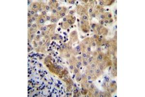 Immunohistochemistry analysis in formalin fixed and paraffin embedded human liver tissue reacted with LIN7C Antibdy (C-term) followed by peroxidase conjugation of the secondary antibody and DAB staining. (LIN7C anticorps  (C-Term))