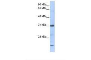 Image no. 1 for anti-Chemokine (C-X-C Motif) Ligand 16 (CXCL16) (C-Term) antibody (ABIN6737989) (CXCL16 anticorps  (C-Term))