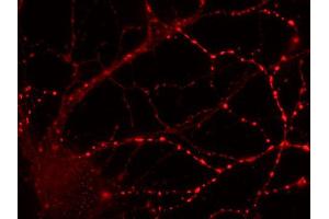 Immunocytochemistry on cultured hippocampus neurons (dilution 1 : 500).