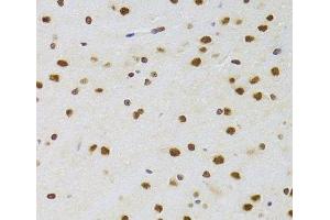 Immunohistochemistry of paraffin-embedded Rat brain using CSRP3 Polyclonal Antibody at dilution of 1:100 (40x lens). (CSRP3 anticorps)