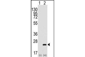 Western blot analysis of BarX1(arrow) using rabbit polyclonal BarX1 Antibody (C-term) (R). (BARX1 anticorps  (AA 119-148))
