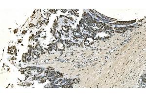 IHC analysis of LSM7 using anti-LSM7 antibody (ABIN7598937). (LSM7 anticorps  (AA 1-103))