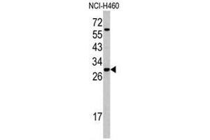 Western blot analysis of SFRS5 antibody (Center Y85) in NCI-H460 cell line lysates (35ug/lane). (SRSF5 anticorps  (Middle Region))