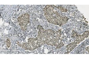 IHC analysis of PARP using anti-PARP antibody (ABIN7602278). (PARP1 anticorps  (AA 670-858))