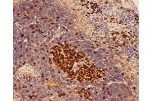 IHC-P: Beclin 1 antibody testing of mouse spleen tissue