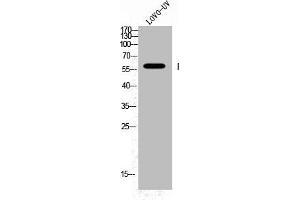 Western Blot analysis of LOVO+UV cells using Phospho-Fyn (Y530) Polyclonal Antibody