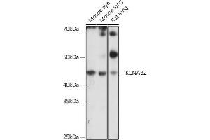 Western blot analysis of extracts of various cell lines, using KCN antibody (ABIN7269481) at 1:1000 dilution. (KCNAB2 anticorps  (AA 1-40))