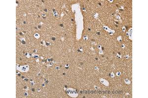 Immunohistochemistry of Human brain  using PPP3CA Polyclonal Antibody at dilution of 1:40 (PPP3CA anticorps)