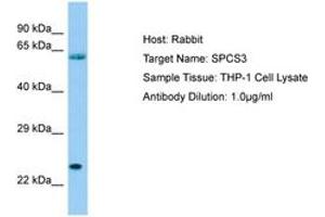 Image no. 1 for anti-Signal Peptidase Complex Subunit 3 Homolog (SPCS3) (AA 51-100) antibody (ABIN6750074)