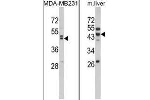 (LEFT) Western blot analysis of WNT10B Antibody (Center) in MDA-MB231 cell line lysates (35ug/lane). (WNT10B anticorps  (Middle Region))