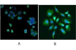 IF/ICC testing of human A) MCF7 and B) HeLa cells with DJ-1 antibody at 5ug/ml + DAPI nuclear counterstain. (PARK7/DJ1 anticorps)